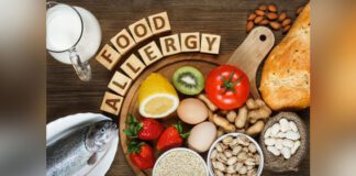 Allergy food as almonds, milk, pistachios, tomato, lemon, kiwi, trout, strawberry, bread, sesame seeds, eggs, peanuts and bean on wooden table