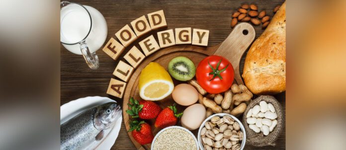 Allergy food as almonds, milk, pistachios, tomato, lemon, kiwi, trout, strawberry, bread, sesame seeds, eggs, peanuts and bean on wooden table